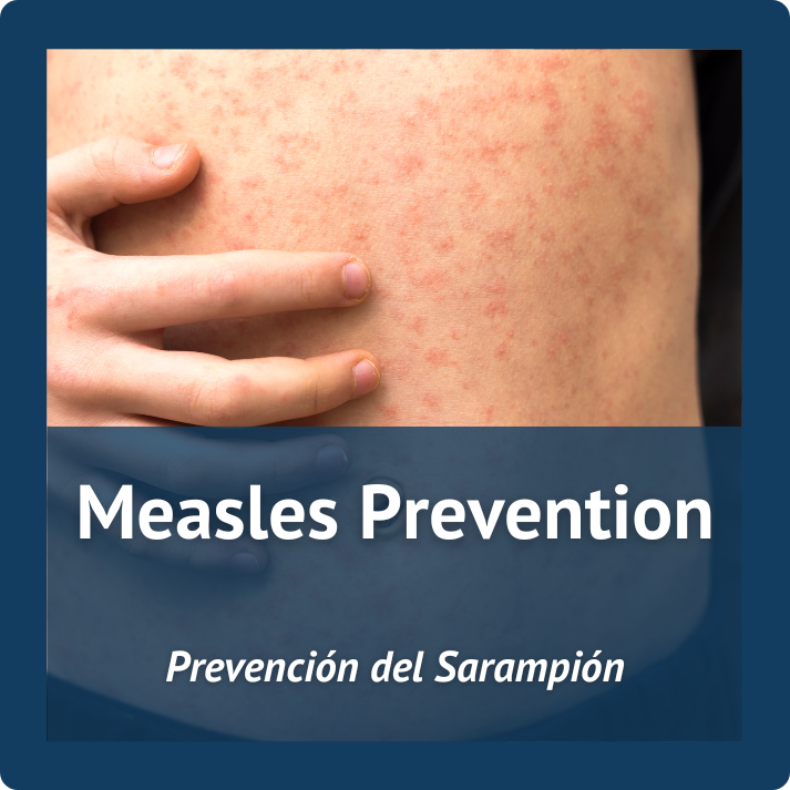 measles.png